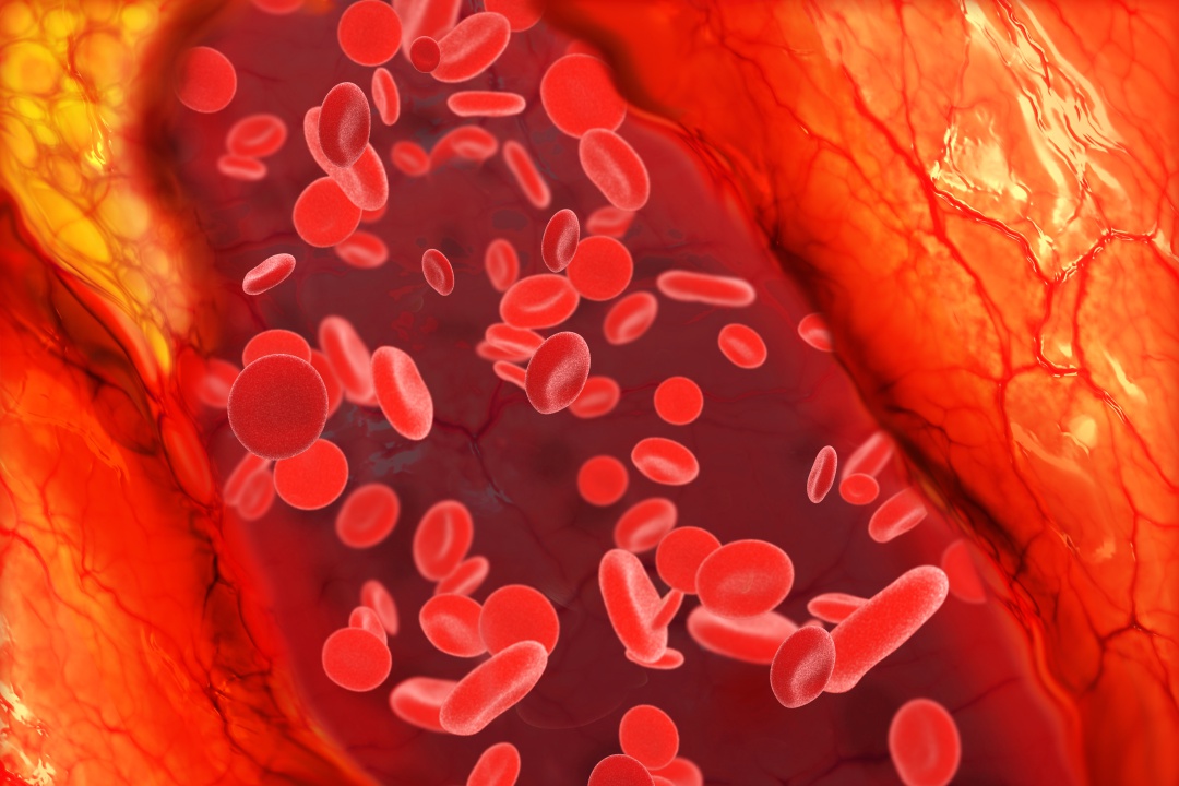 jak snížit hladinu cholesterolu v těle - obrázek 02